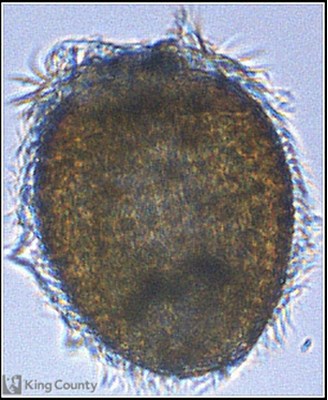 Photo of Didinium
